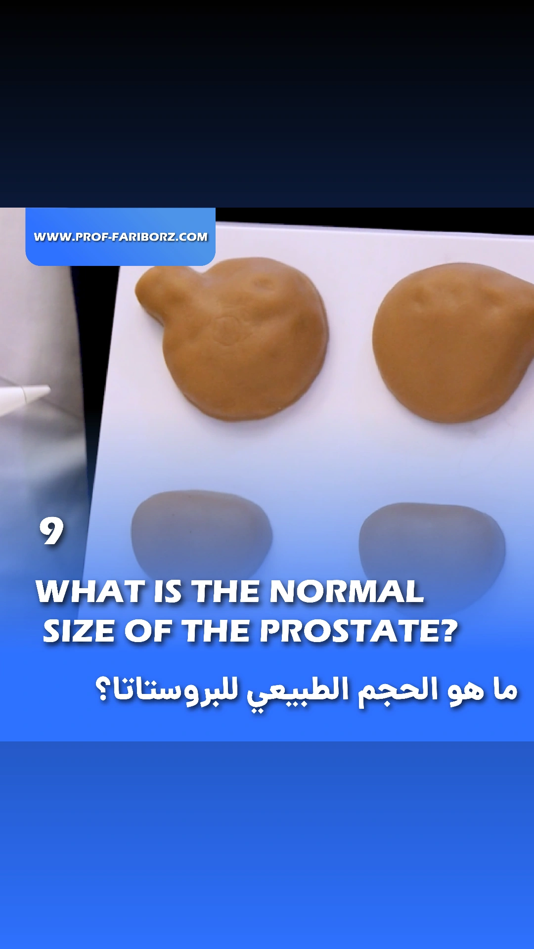 Video 9: What is the normal size of the prostate? - Professor Fariborz ...