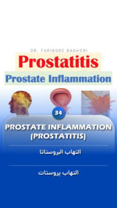 General Information 9 Prostate Inflammation Prostatitis - Fariborz Bagheri
