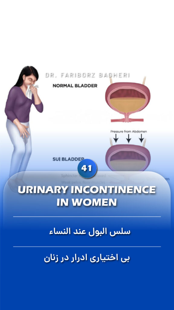 Urinary incontinence in women - Fariborz Bagheri