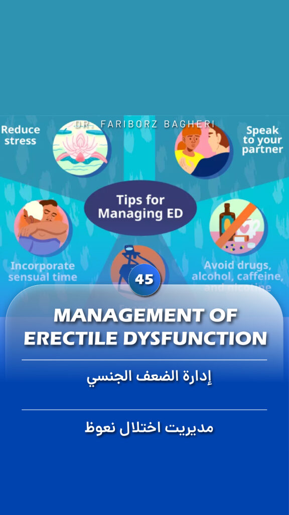 Management of Erectile Dysfunction - Fariborz Bagheri