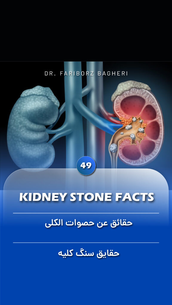 Kidney Stone Facts - Fariborz Bagheri