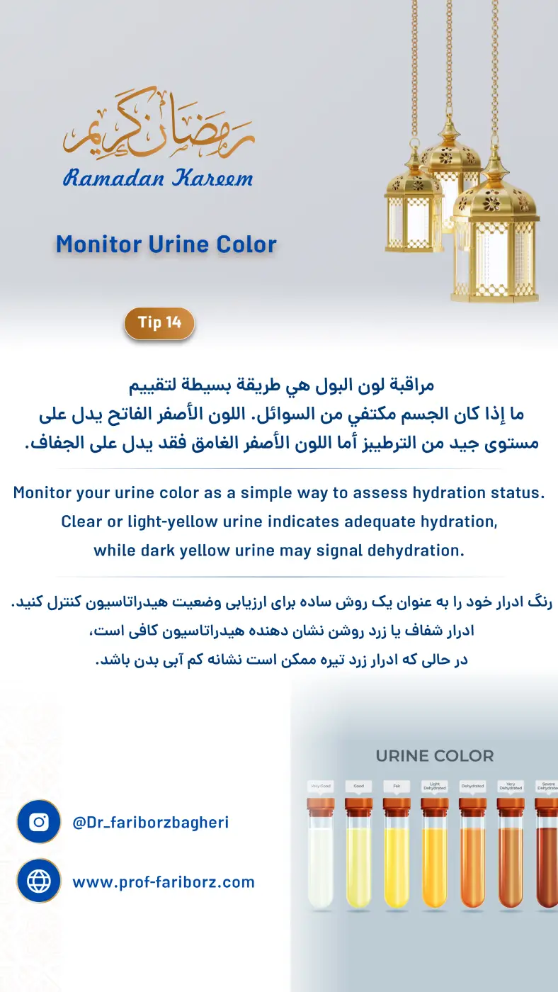 Monitor Urine Color - Fariborz Bagheri