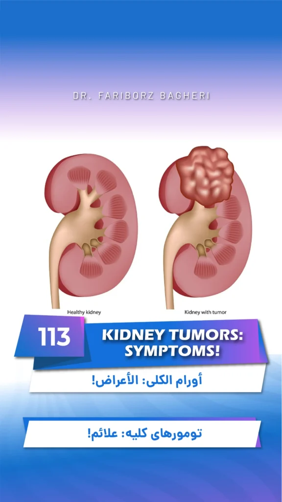 Kidney Tumors: Symptoms!