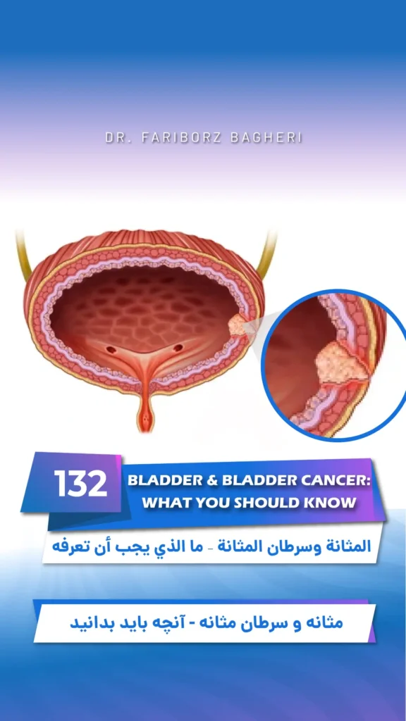 Bladder Cancer