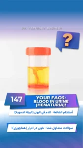 General Information 1 Video 147: Your FAQs – Blood in Urine Hematuria