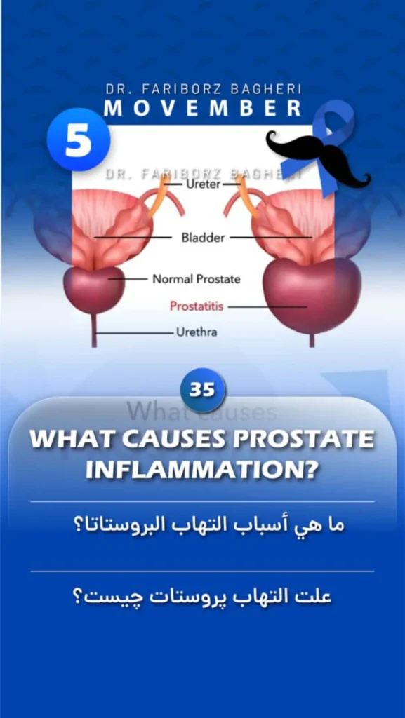 Causes of Prostate Inflammation
