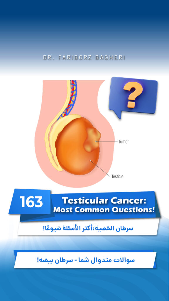 Common Questions About Testicular Cancer explained by a urologist
