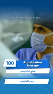 Video 180: Aquablation Therapy: