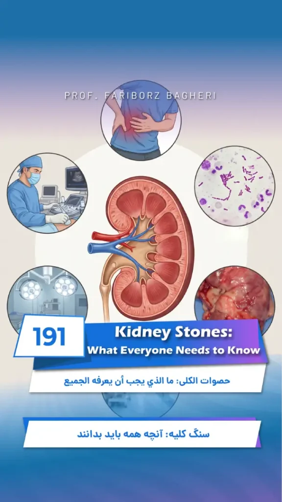 Kidney Stones