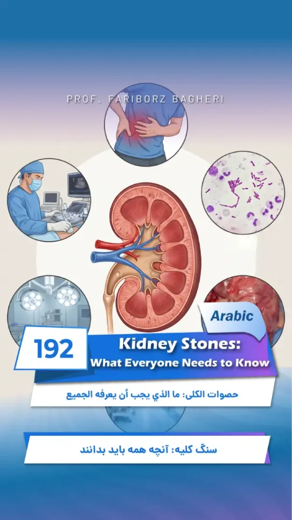 Kidney Stones