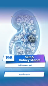 Salt Intake and Kidney Stones