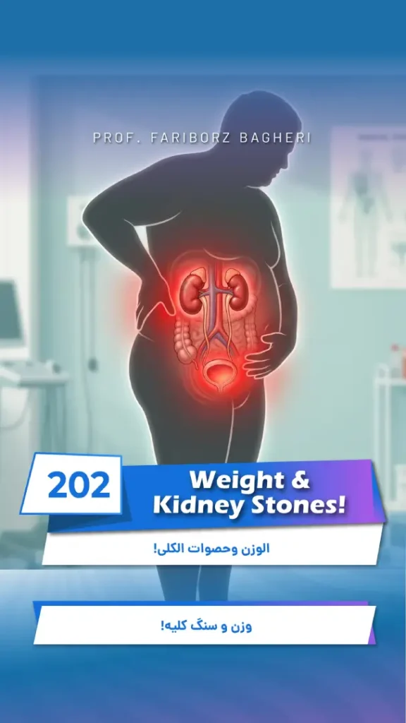 weight and kidney stones