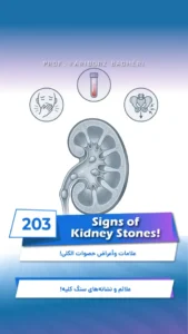 Kidney Stone Symptoms – Common Signs of Kidney Stones