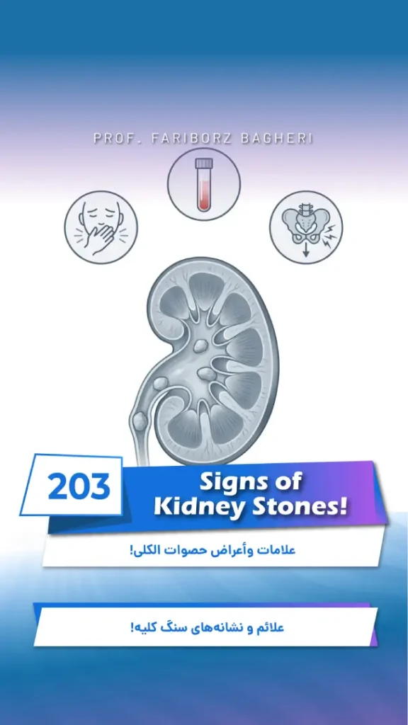 Kidney Stone Symptoms – Common Signs of Kidney Stones